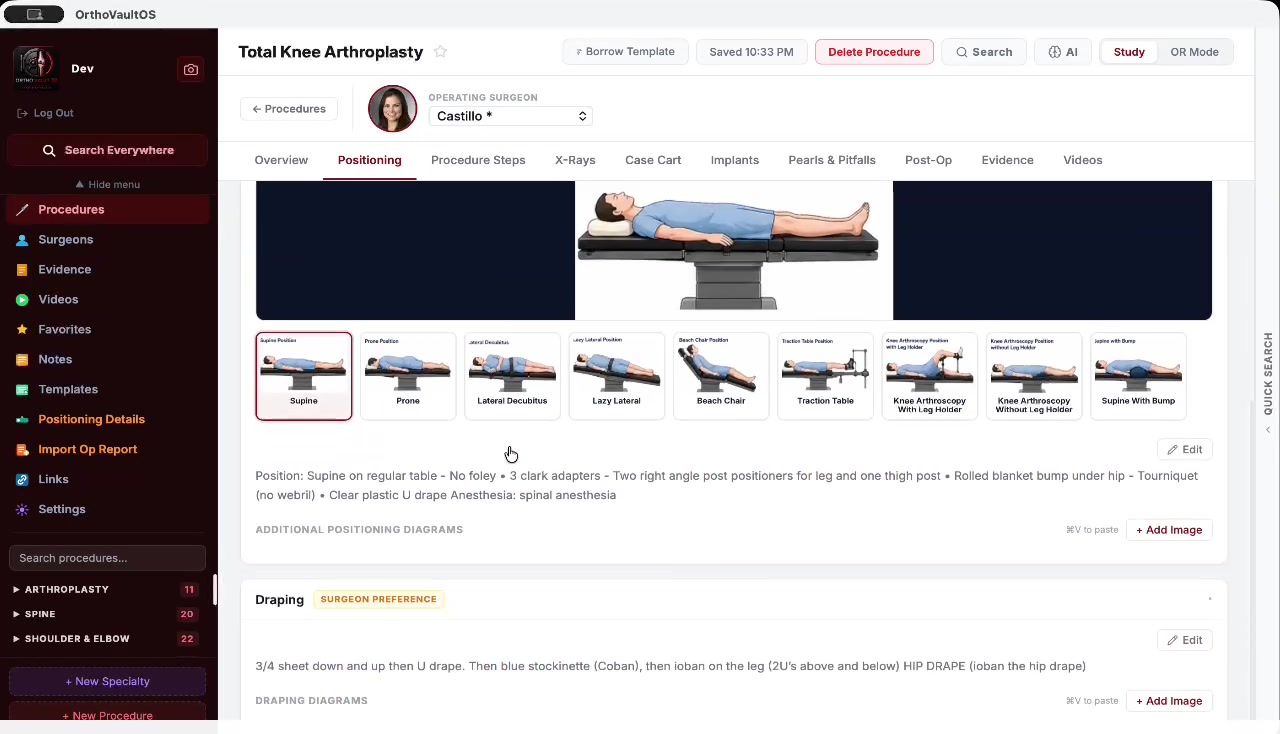 Patient positioning at a glance
