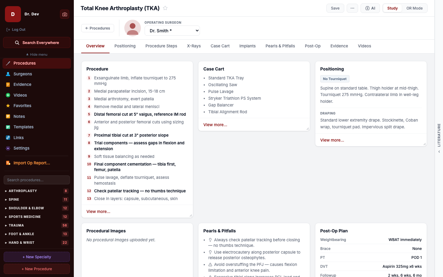 An OrthoVaultOS procedure page for a total knee arthroplasty showing the operating surgeon, procedure steps, case cart, positioning and pearls on one screen