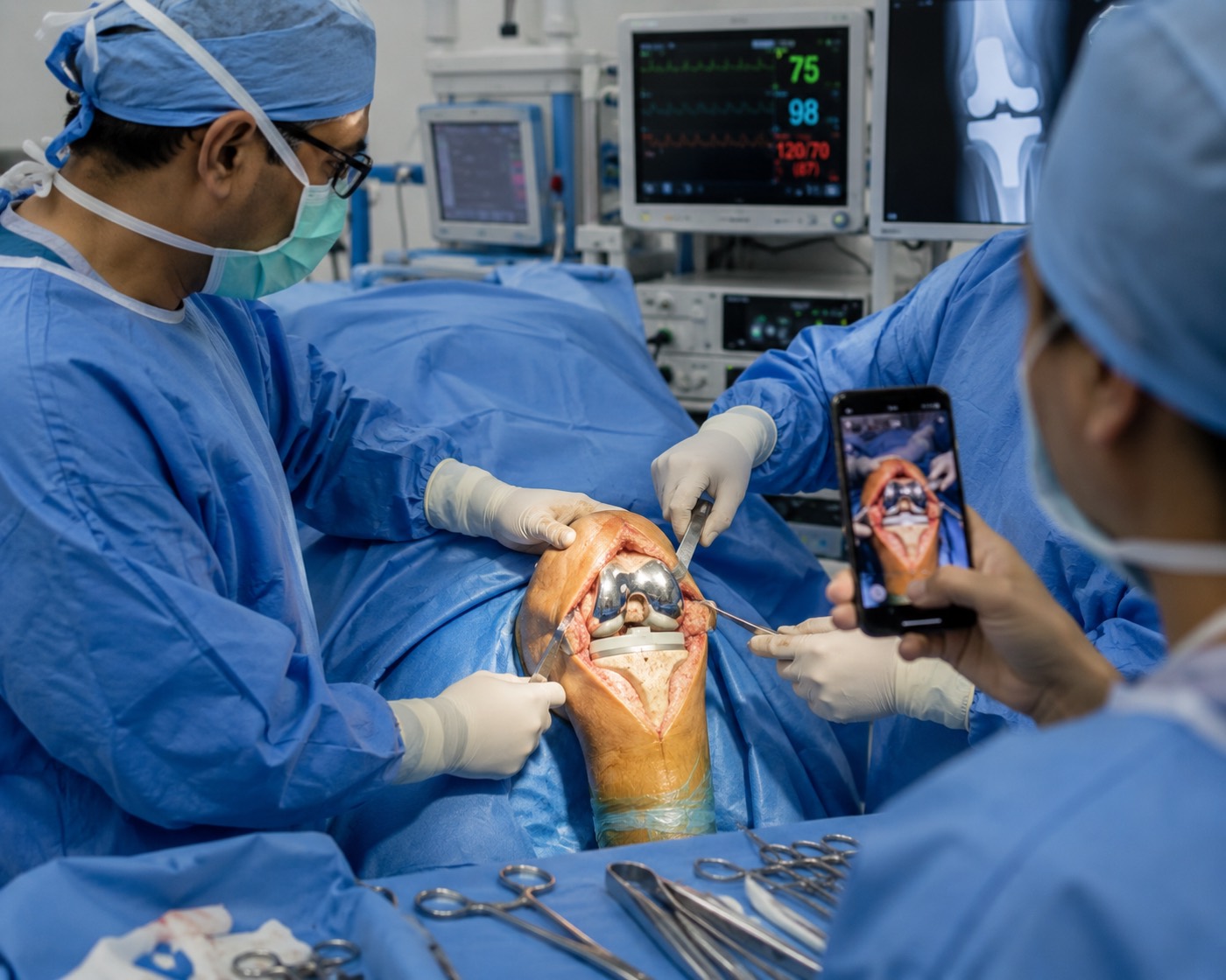 Close-up of an exposed knee joint with retractors placed.